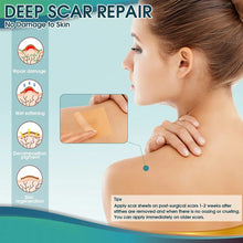 Load image into Gallery viewer, DHUA Silicone Tape for Repair Scars on Your Skin - Bali Lumbung