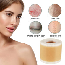 Indlæs billede til gallerivisning DHUA Silicone Tape for Repair Scars on Your Skin - Bali Lumbung