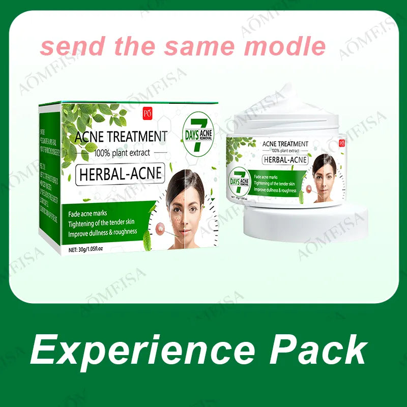 CLOVER #2 Acne Cream Herbal Essence Anti-Inflammatory Suitable for all kinds of Acne  Treatmen