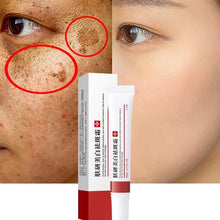 Afbeelding in Gallery-weergave laden, CLOVER Dark Spot/ Melasma Cream Remover Treatment - Bali Lumbung