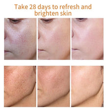 Indlæs billede til gallerivisning CLOVER Dark Spot/ Melasma Cream Remover Treatment - Bali Lumbung